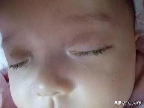 二个月的宝宝感冒鼻塞怎么办,二个月的宝宝感冒鼻塞怎么办？家长必看护理指南