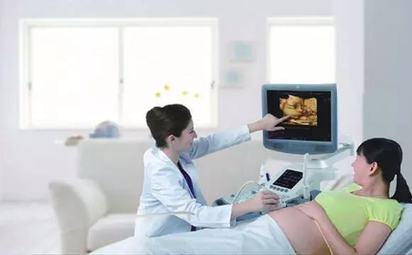 几个月照四维最好,几个月照四维最好，孕期彩超的最佳时间选择